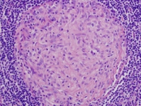 Ağız İçi Epitel Hücresi Özellikleri ve Faydaları Nelerdir?